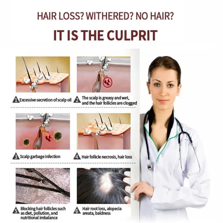 LiQT Anti–Hair Growth Ginger Shampoo ( BUY 1 GET 1 FREE )