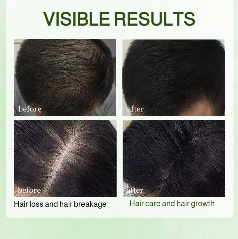 Pure Handmade Usman Hair Growth Soap( BUY 1 GET 1 FREE )