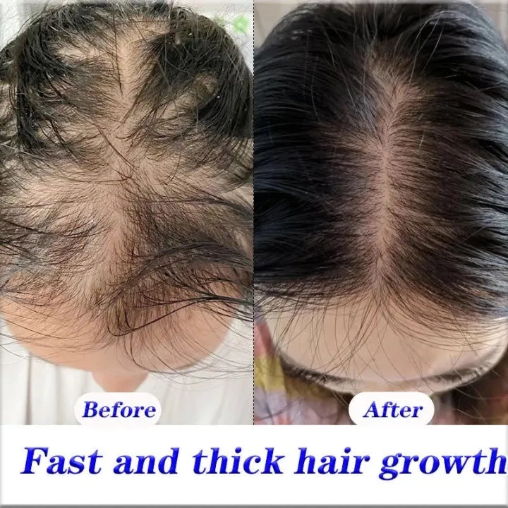 IUALLURE™ Ginger Development Shampoo ( BUY 1 GET 1 FREE )