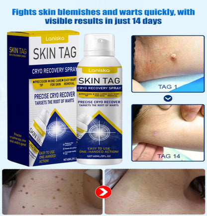 LANISKA Wart Care Topical Spray