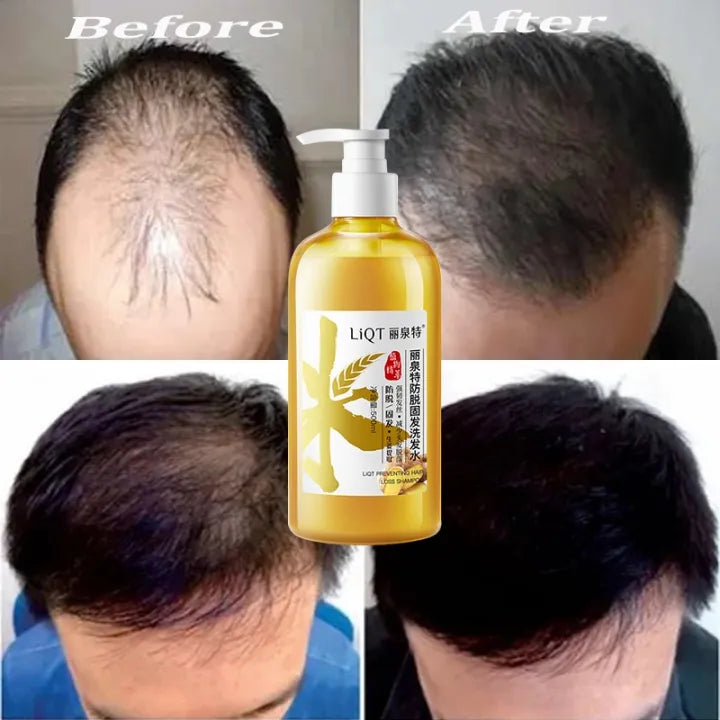 LiQT Anti–Hair Growth Ginger Shampoo ( BUY 1 GET 1 FREE )