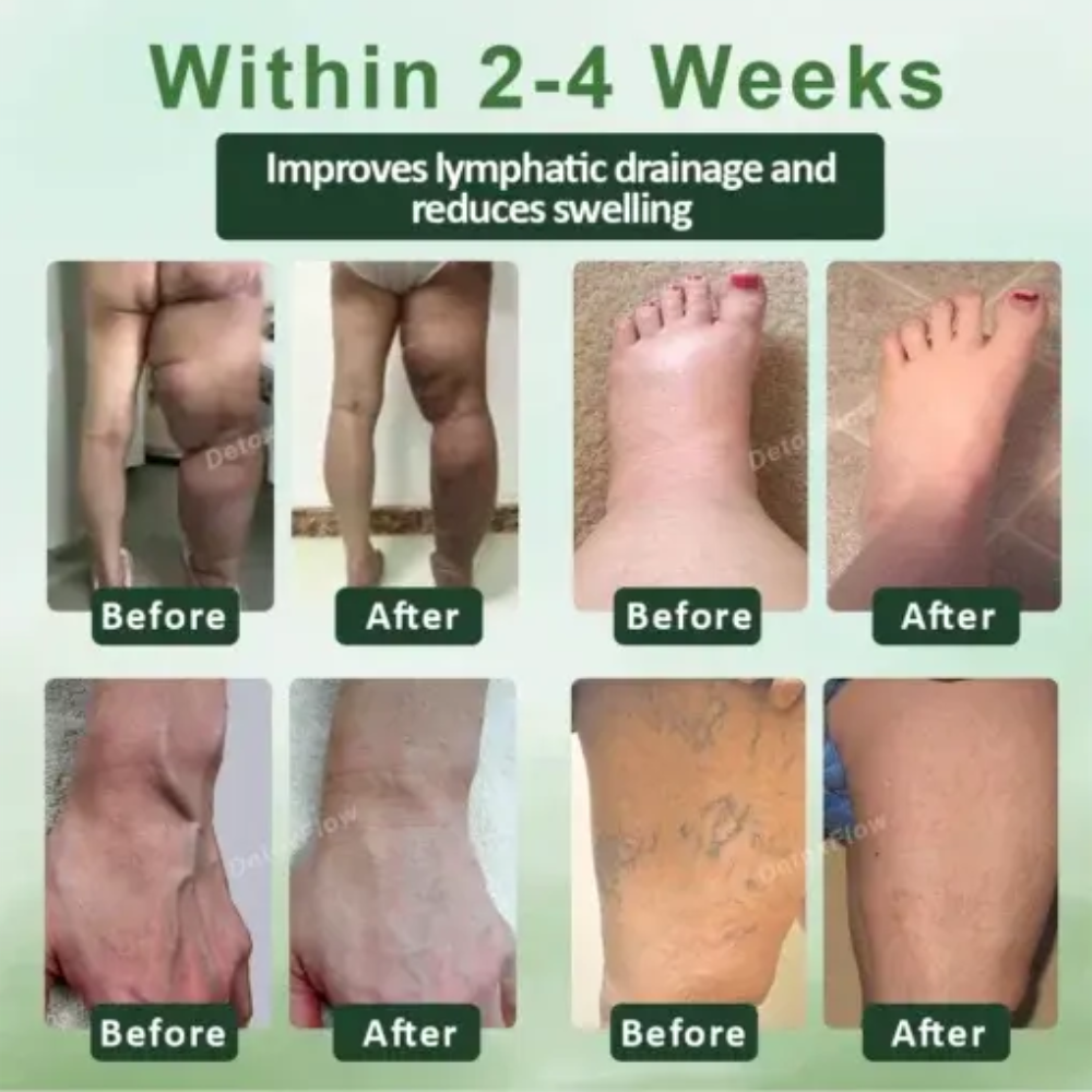 DetoxFlow™ SwellRelief Lymphatic Foot Pads( BUY 1 GET 1 FREE )