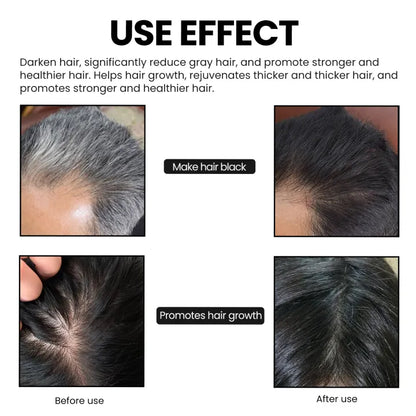 Ouhoe™ Organic Bamboo Charcoal Shampoo Soap 🌿🖤