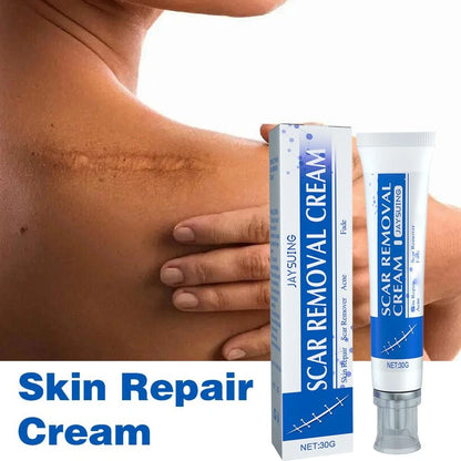 JAYSUING™ Scar Removal Cream ( BUY 1 GET 1 FREE )