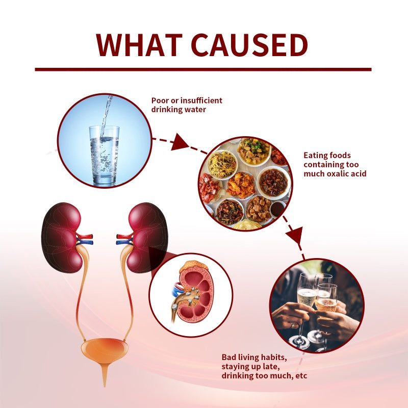 💧🌿 SouthMoon™ Renal Stone Patch ( BUY 1 GET 1 FREE )