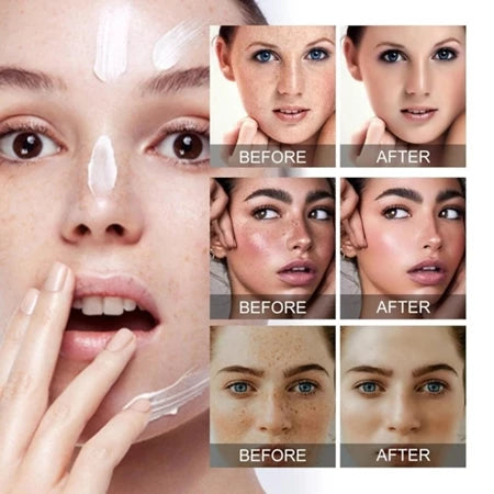 🌺🌙 GlowFade Radiance Repair Cream – Freckle, Pigmentation & Acne Scar Solution 🌸💧