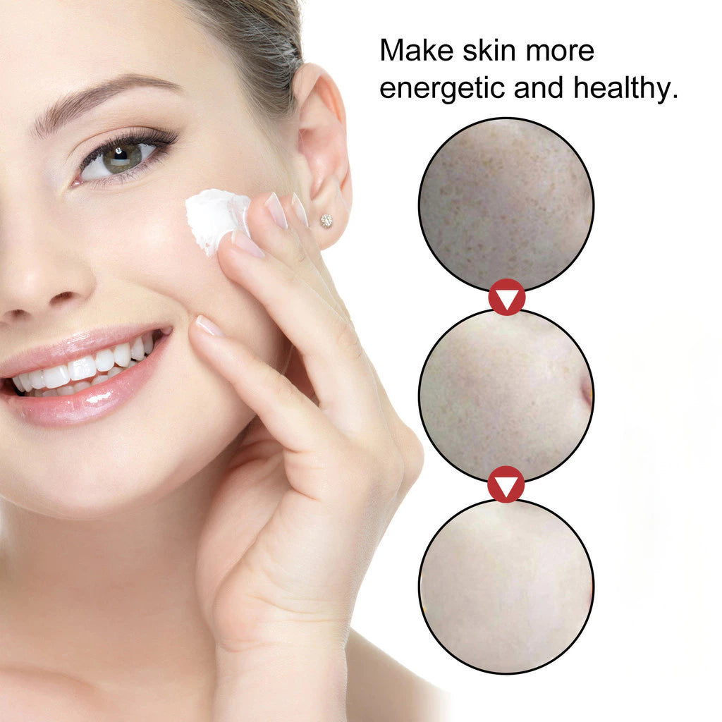 🌺🌙 GlowFade Radiance Repair Cream – Freckle, Pigmentation & Acne Scar Solution 🌸💧