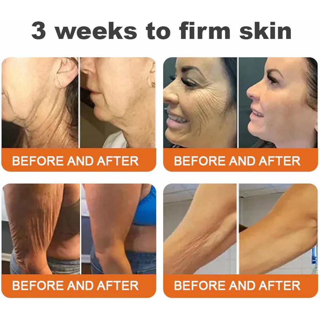 BOTOXMIX Bee Venom Firming Serum Stick( BUY 1 GET 1 FREE )