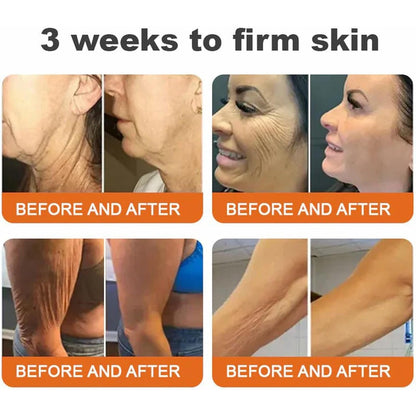 BOTOXMIX Bee Venom Firming Serum Stick( BUY 1 GET 1 FREE )