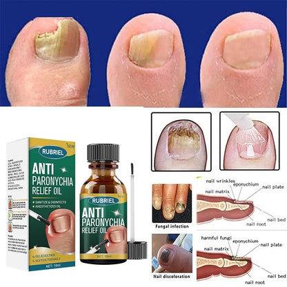 Anti Paronychia Relief Oil ( BUY 1 GET 1 FREE )