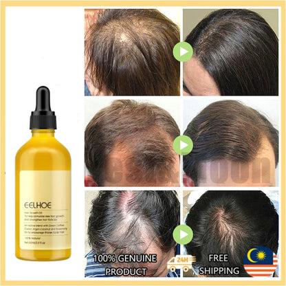 Imported Rosemary Hair Growth Oil ( BUY 1 GET 1 FREE )